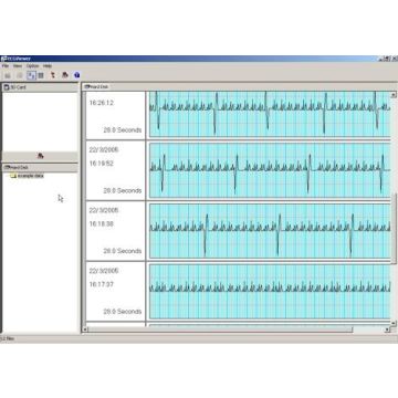 Omron HCG-801 Heartscan ECG Software Extension Pack (no monitor)